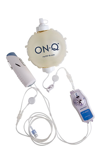 ON-Q* with ONDEMAND* and SAF*